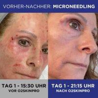 O2SkinPro 60ml