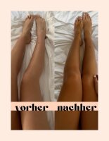 nüdes medium